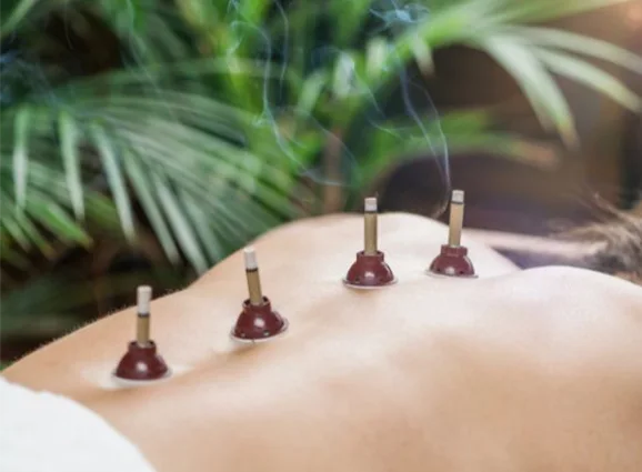 Moxibustion Therapy